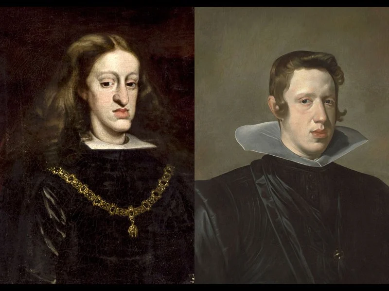 Habsburg Jaw: The Horrific Consequences of ‘Royal Inbreeding’ in Europe